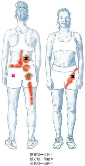 髂腰肌—红色×腰方肌—黑色×梨状肌—绿色