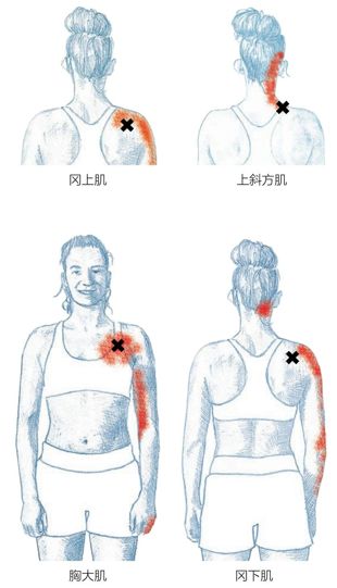 冈上肌 上斜方肌胸大肌 冈下肌